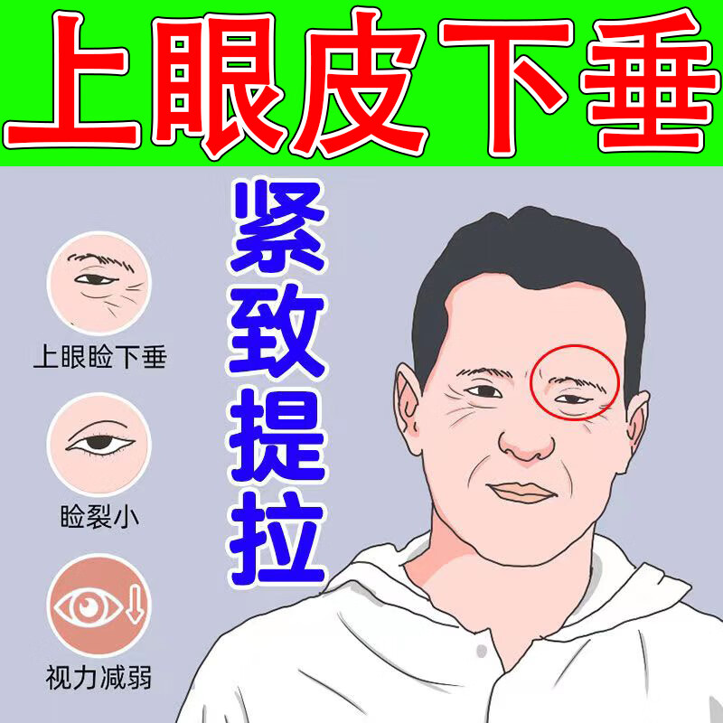 大小眼怎么纠正图片