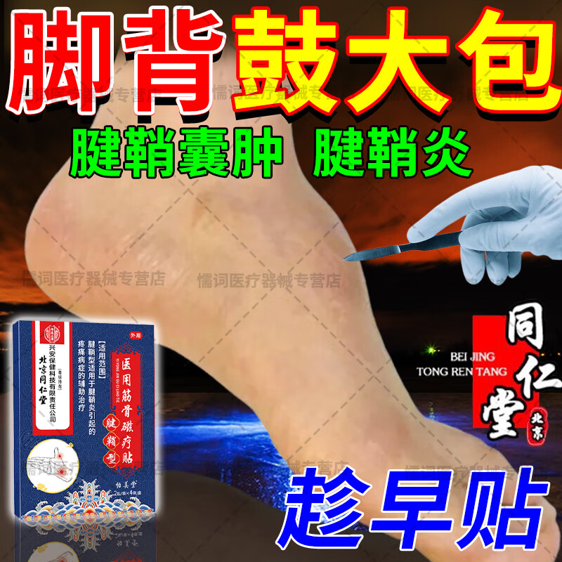 脚背腱鞘炎专用脚背腱鞘囊肿鼓包膏药贴腱鞘囊肿鼓包专用贴脚背脚 单