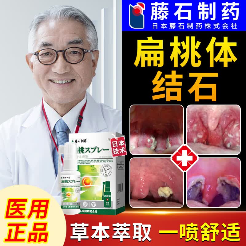 【日本监制】扁桃体结石去除工具医用口腔隐窝冲洗器进口喷雾药儿童