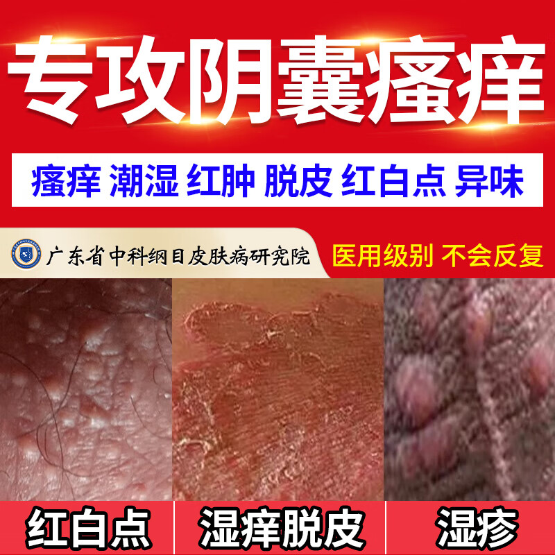 纾大夫阴囊炎阴囊潮湿瘙痒脱皮睾丸瘙痒肛门大腿内侧蛋蛋湿疹抑菌止痒膏 双重功效组合装(轻度)