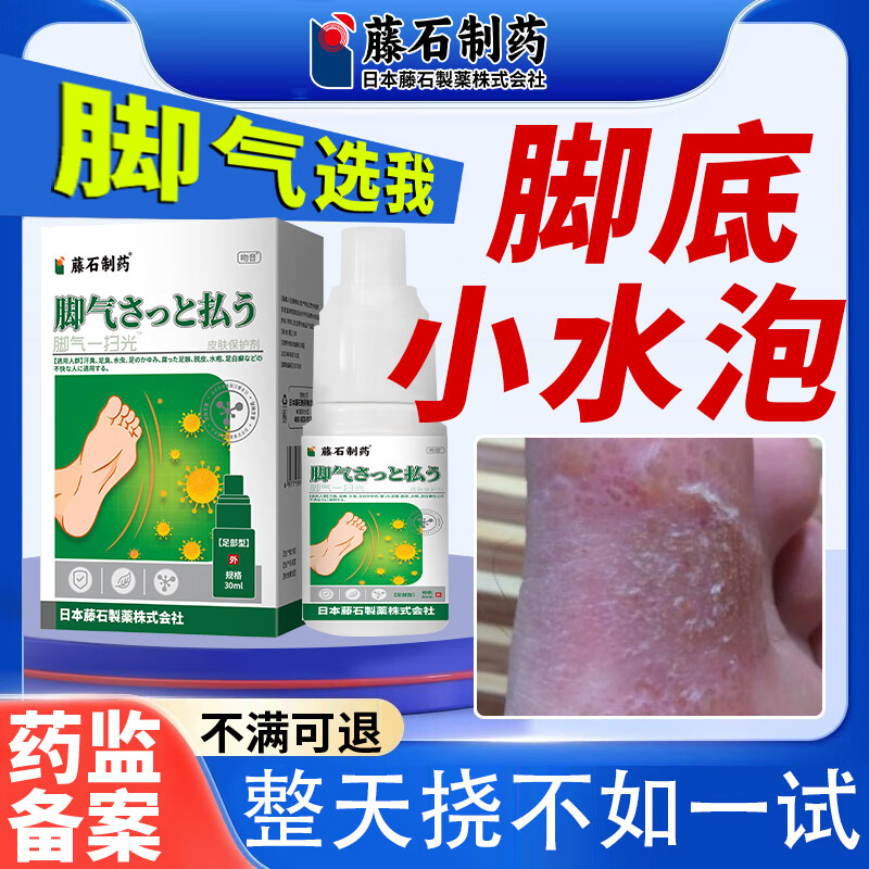 脚气水泡型脚气特傚效喷雾可搭止痒去根乳药膏用真菌感染脚趾缝脚底上