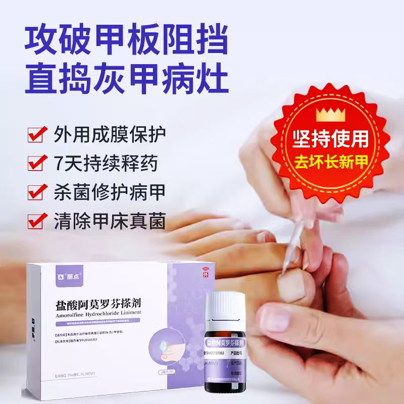 丽点 盐酸阿莫罗芬搽剂 5%*2ml治疗敏感真菌引起的指甲趾甲感染灰指甲