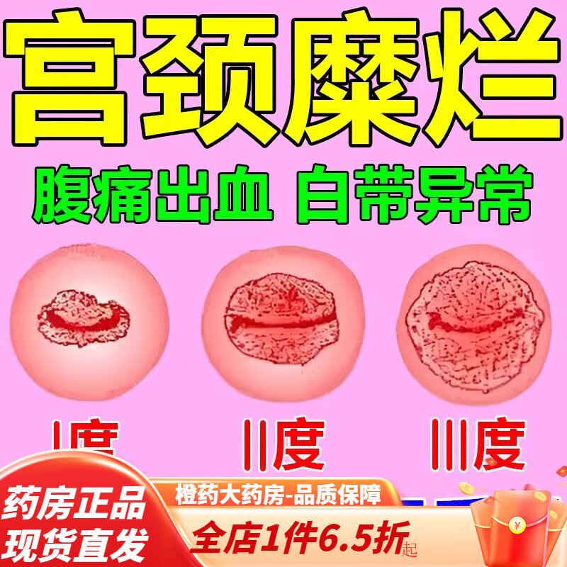 妇炎洁凝胶同房 消糜栓凝胶炎妇科用药凝胶私密处 3g*7粒 3盒 【宫颈