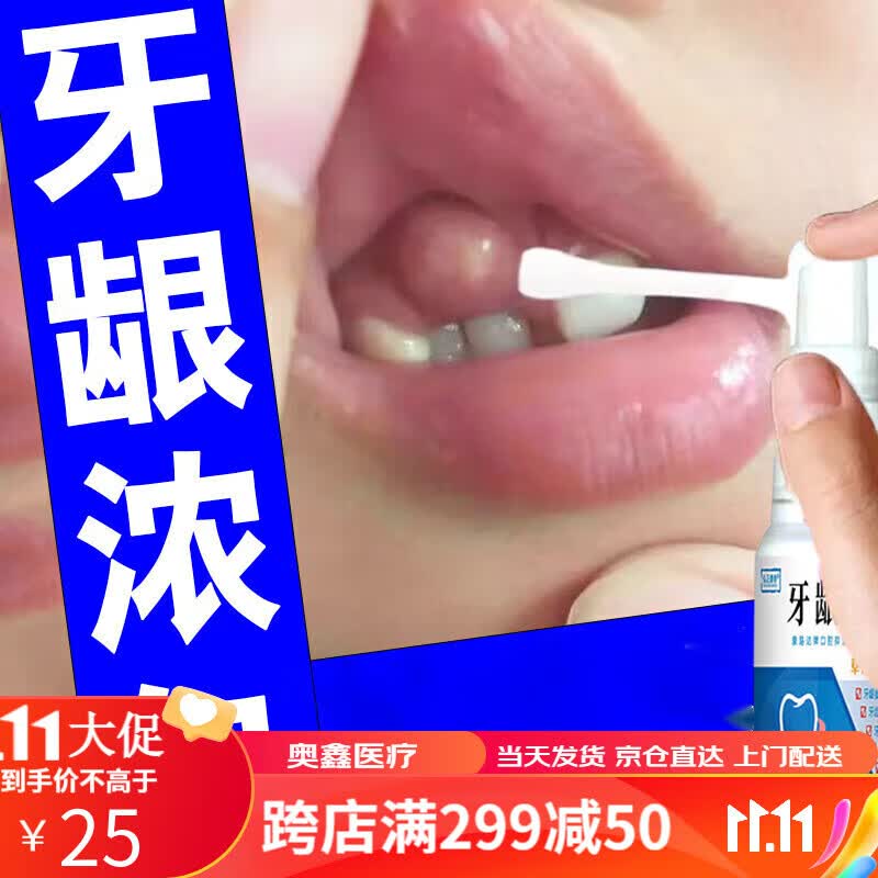 牙龈康适用于牙龈脓肿牙龈肿包牙根瘘管囊肿长脓包鼓包喷剂 一盒装
