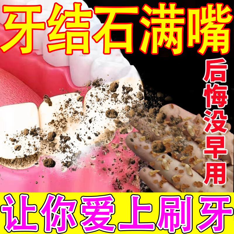 单盒体验装轻度牙结石
