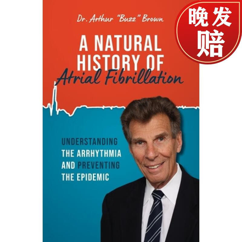 history of atrial fibrillation: understanding the arrhythmia