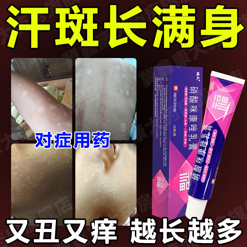 汗斑专用药汗斑花斑癣除树根 花斑癣专用药皮肤用药汗斑专用药成人