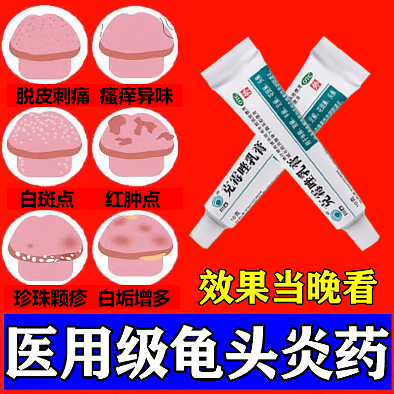 龟头炎专用药 龟头炎包皮炎专用药真菌感染男士私处洗液杀菌消炎止痒