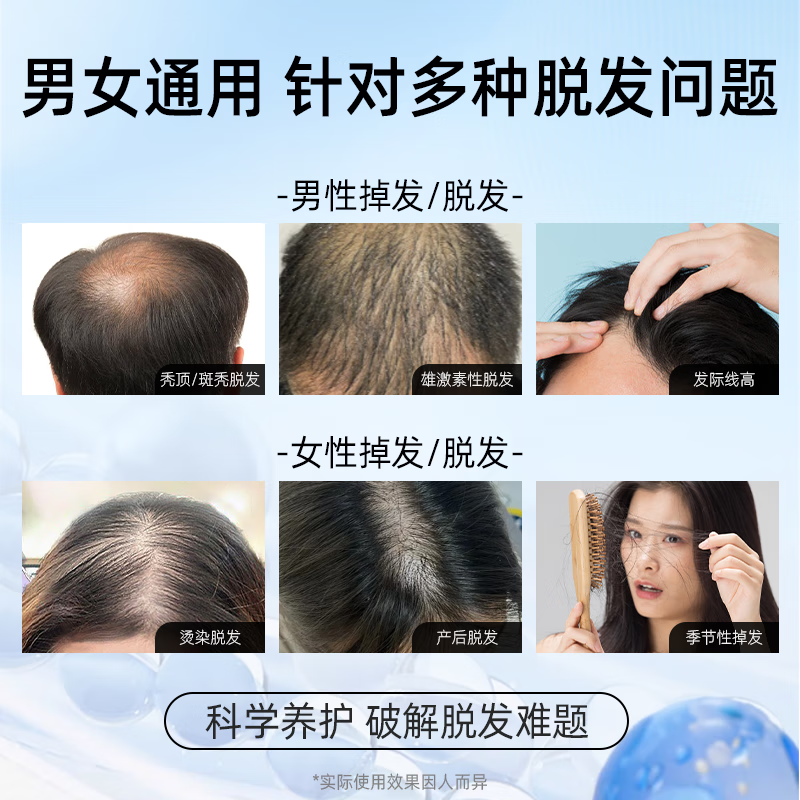 Nebe防脱固发洗发水护养头皮控油去屑蓬松柔顺洗发露男女官方正品 防脱洗发水300ml*1