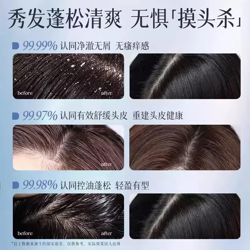 维特丝二硫化硒去屑洗发水止痒控油蓬松头皮清爽男女士洗头膏露改善毛囊 【控油去屑净螨】升级超值2瓶装