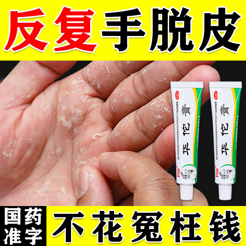 手脱皮药膏 手脱皮用什么药 手脱皮膏真菌感染手皮开裂干裂 起皮脚气