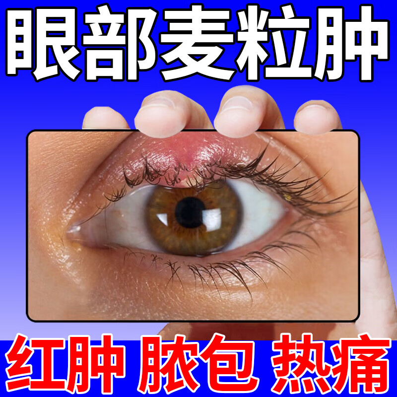 麦粒肿眼贴霰粒肿针眼药睑板腺囊肿炎眼睛肿去浮肿专用冷敷眼贴 单