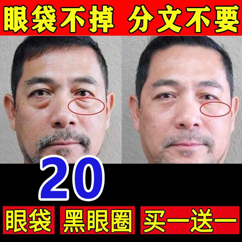 消浮肿神器眼带霜男士专用眼霜男祛眼代消除黑眼圈去除眼带消除神器