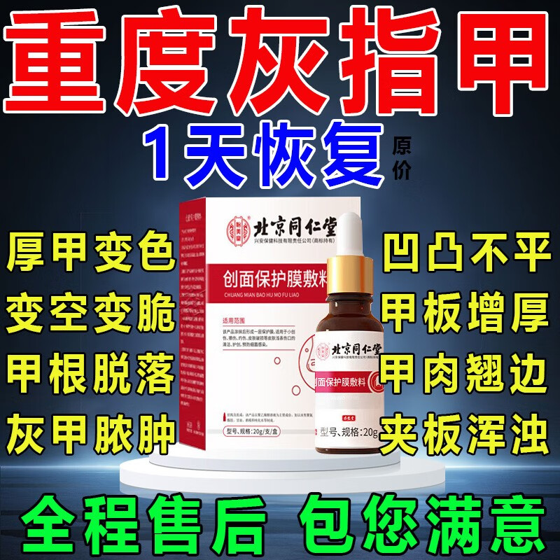 灰指甲甲沟炎特傚效药根i治正品治疗去灰指甲专的用药抑菌液药膏真菌