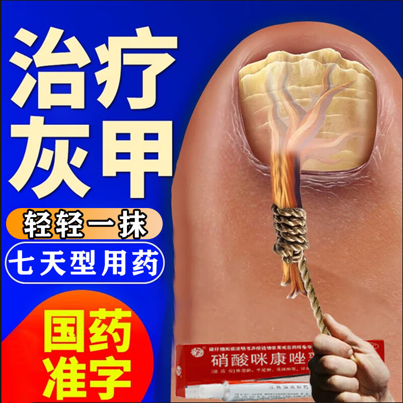 治疗甲癣灰指甲特厚的效药根难的治可搭配灰指甲药膏指甲真菌感染脱甲
