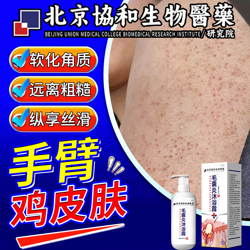 手臂鸡皮肤疙瘩毛囊角化症专用毛囊炎沐浴露去鸡皮肤毛囊角质疙瘩大腿