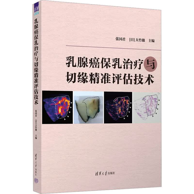乳腺癌保乳治疗与切缘精准评估技术 图书属于什么档次？