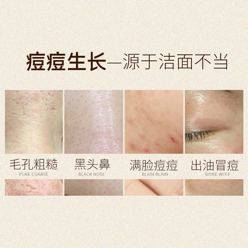 老中医祛痘精华洗面奶 男女士弱酸性洁面乳缓解痘痘生长无泡舒爽不干涩 祛痘精华洗面奶150g