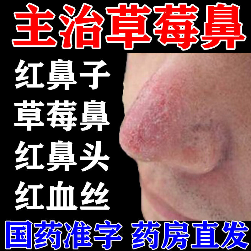 一盒【鼻子红肿痒】 1包棉签
