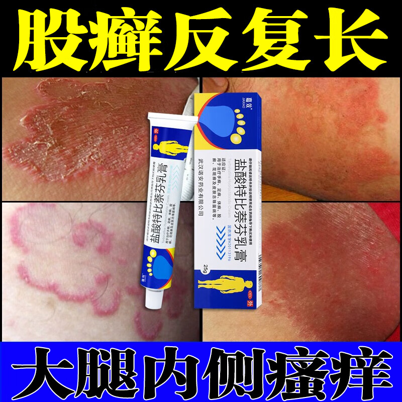 股癣专用药膏阴囊私处瘙痒股藓大腿内侧瘙痒变黑真菌感染皮肤瘙痒皮炎