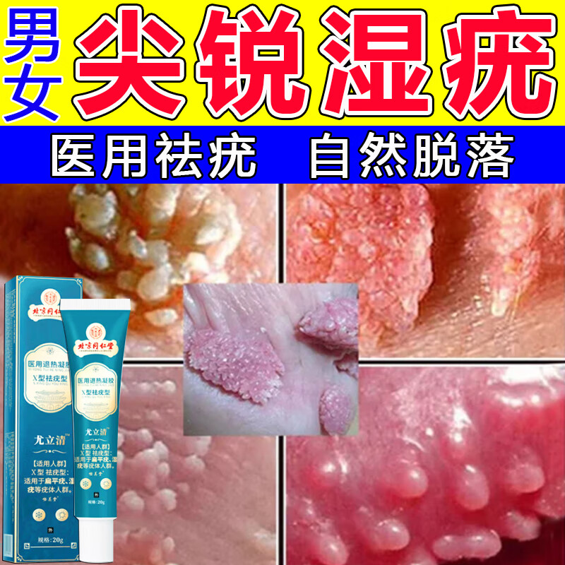 疣跖疣体脱落面部脖子私处祛疣凝胶男女可用 1盒 私处痒丘疹菜花状
