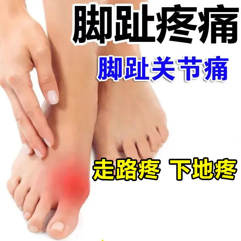 无品牌脚趾疼痛大拇脚指疼脚趾痛脚趾麻木活动受限趾跖关节疼僵硬肿 1