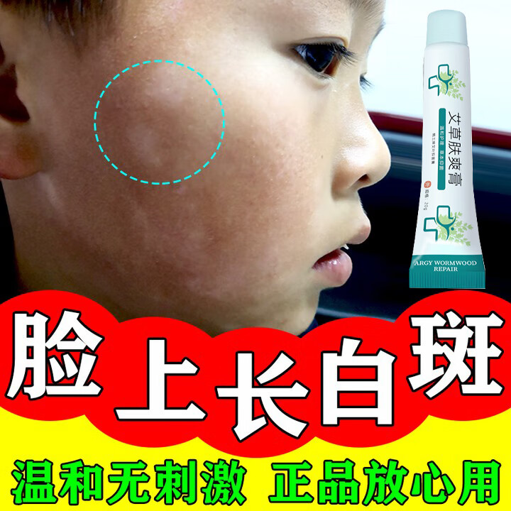 怀化治疗白癜风：最新动态与趋势概览