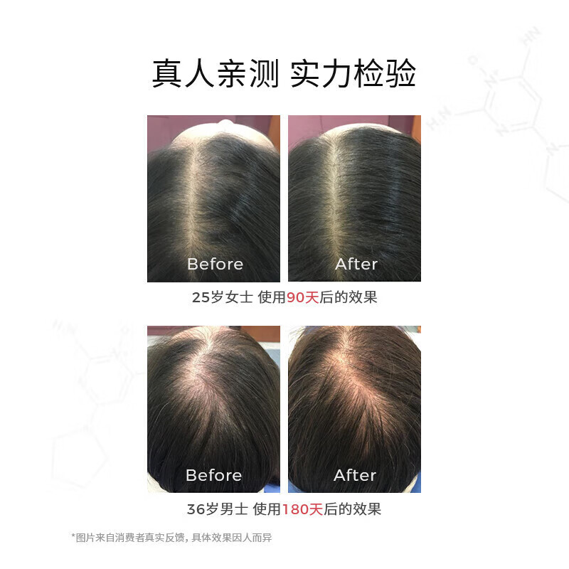 DS Laboratories美国进口DS实验室防脱育发洗发水小橘盖洗头膏咖啡因固发护发素  洗发水100ml【便携装】