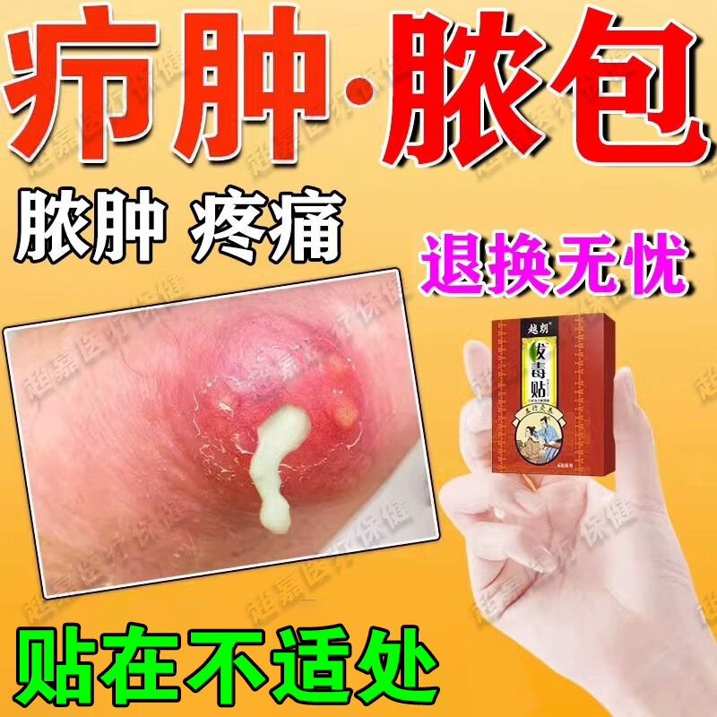 火疖子拔毒贴膏皮下脂肪包块肿瘤膏皮脂腺囊肿粉瘤专用膏贴疖肿纤维瘤