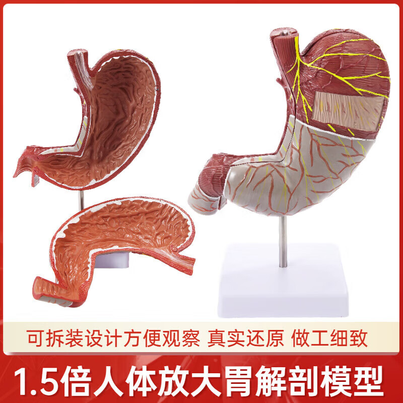5倍放大胃解剖模型胃模型正常胃解剖教学模型人体胃可拆卸