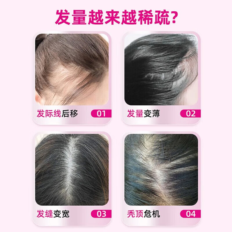 达霏欣米诺地尔酊搽剂30ml 女款2%浓度生发液米诺地尔酊生发喷雾防脱产后脱发斑秃发际线 1盒30ml+300ml丰盈强韧洗发水