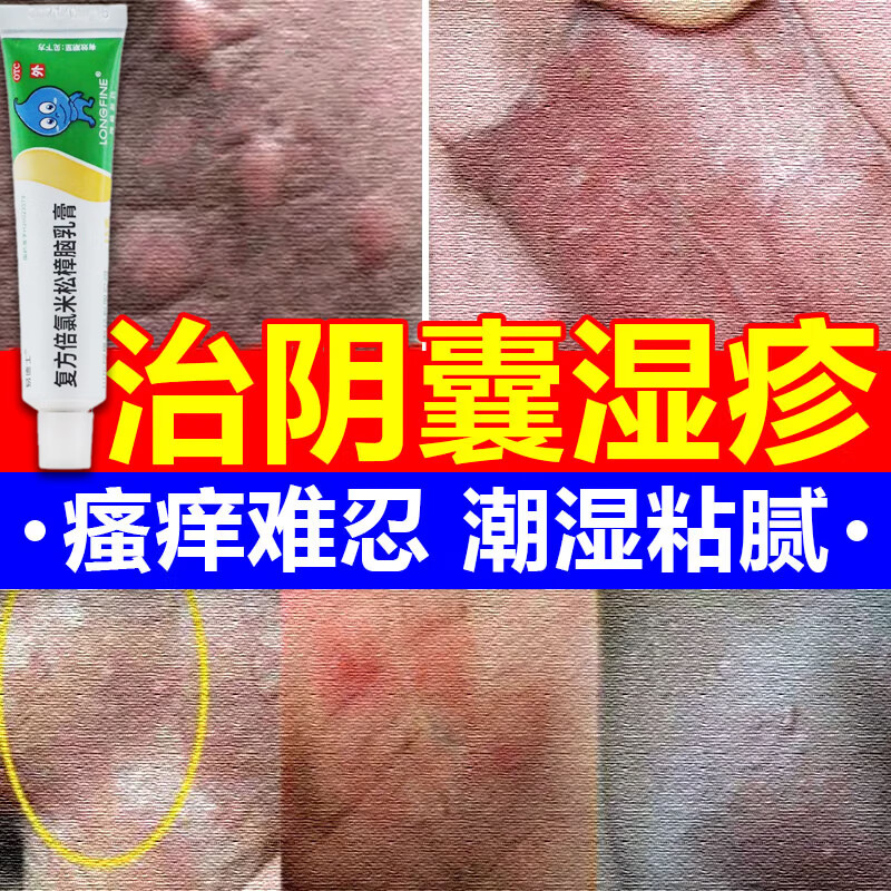 阴囊潮湿瘙痒男人专用止痒去看根 阴囊湿疹专用药下体瘙痒的药止痒