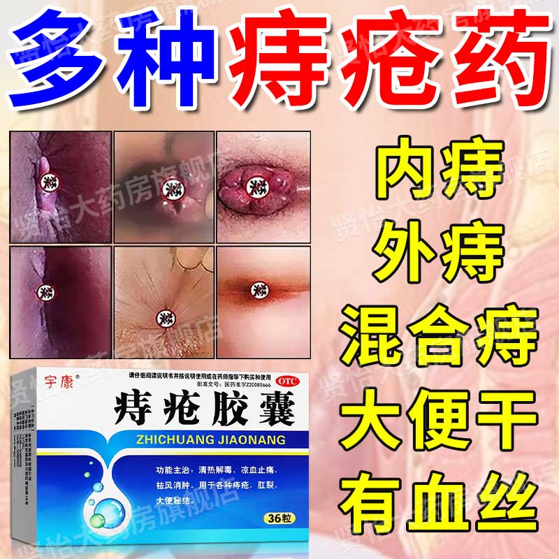 痔疮专用药内痔外痔混合痔根去断去肉球神器 治肛门特瘙痒肛裂大便