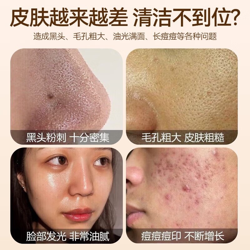 膜法记忆多酸净肤洁面乳壬二酸洗面奶男女深层清洁收缩毛孔去黑头2支装