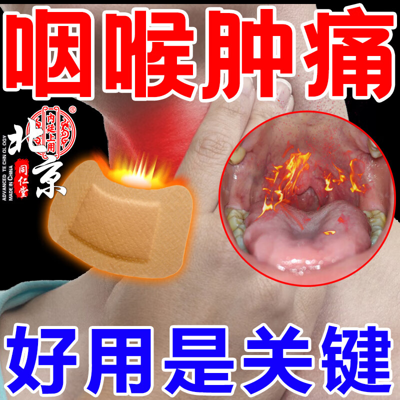 喉咙干呕痒异物感急慢性咽炎喉咙有痰化痰滤泡增生咽扁咽炎型颈部穴 1