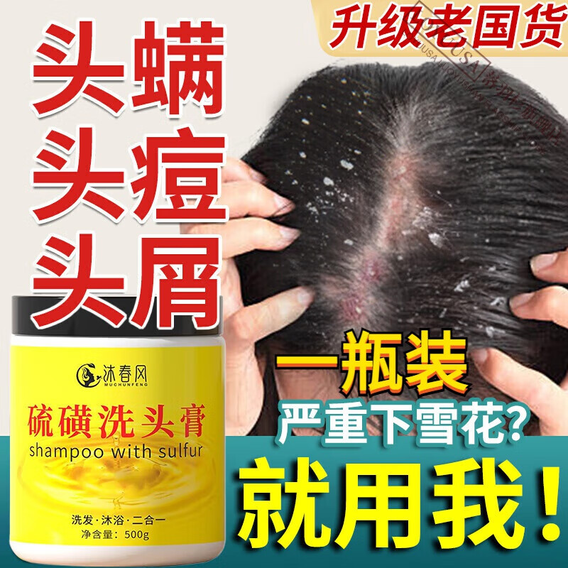 三黃洗劑毛囊炎硫磺洗頭膏頭皮屑脂溢性皮炎外用去屑止癢除螨 一瓶體驗裝