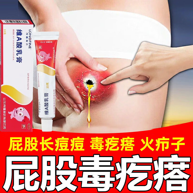 坐板疮专用药膏火疖子药膏专用药膏脖子后面长痘白色脓包红肿流脓毒气