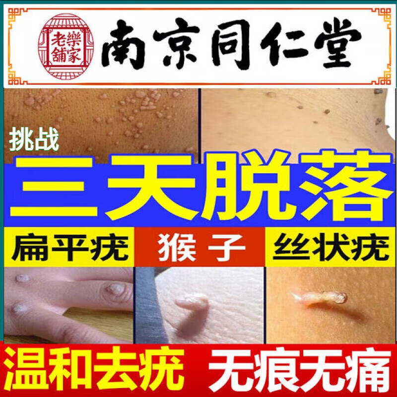 扁平疣专用非药去猴子扁平疣面部脖子草本克疣液净肤抑菌液皮肤外用