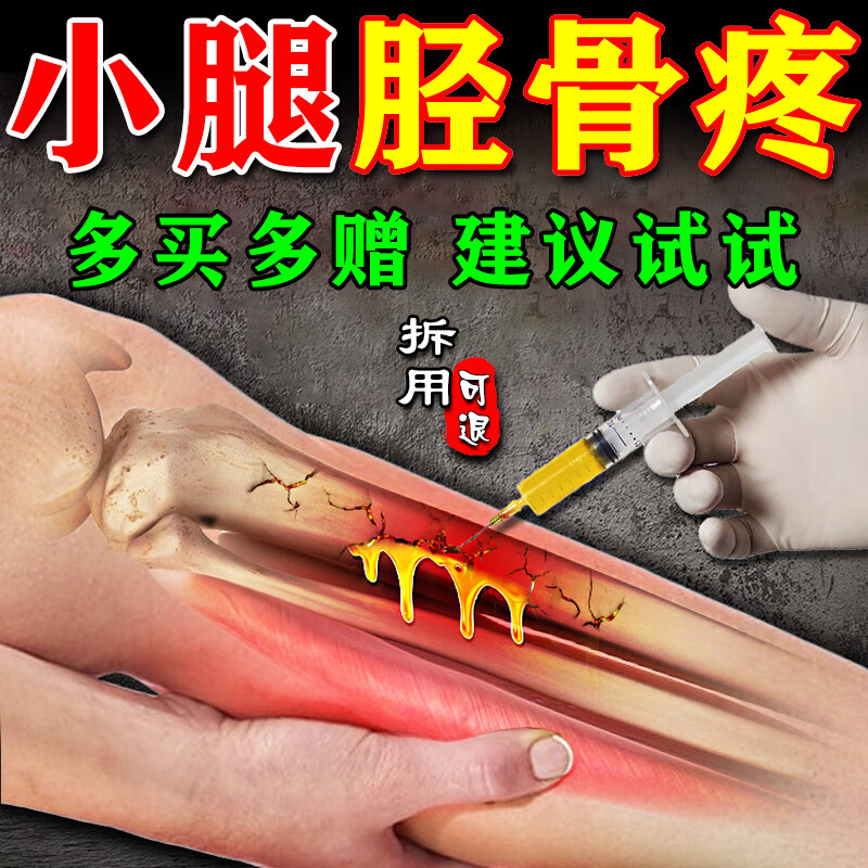 胫骨骨膜l炎膏贴小腿前侧肌肿胀肌肉酸痛筋膜疼肌肉痛活动受限专l用