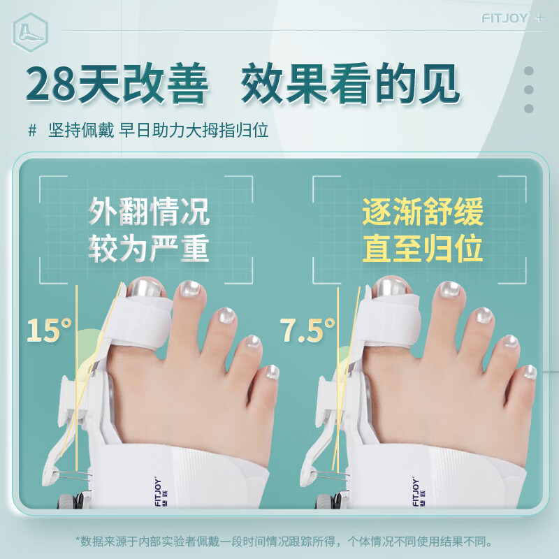 【升级旋钮调节】脚趾矫正器大脚拇指外翻矫正器脚型矫正器分趾器纠正脚趾大脚趾拇外翻矫正器 双只装【居家角度可调节+日用硅胶可穿鞋】 34~45码可穿+左右脚通用+日夜套装+无痛矫正