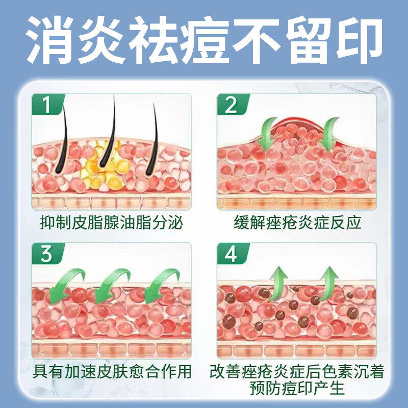北京同仁堂 痤疮膏重度暗疮男女初中生腮边青春痘脸上额头下巴起小疙瘩痤疮膏专用痤疮凝胶 三盒装【买2送1】