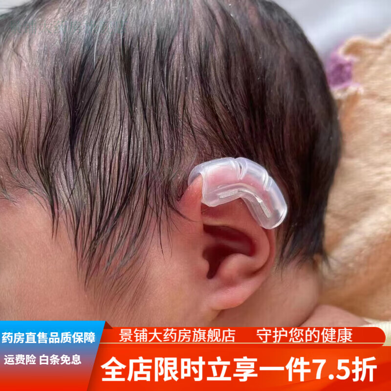 内置婴儿耳朵矫形器小儿贴耳廓贴纠正塑形耳轮定型牵引器 双耳耳托