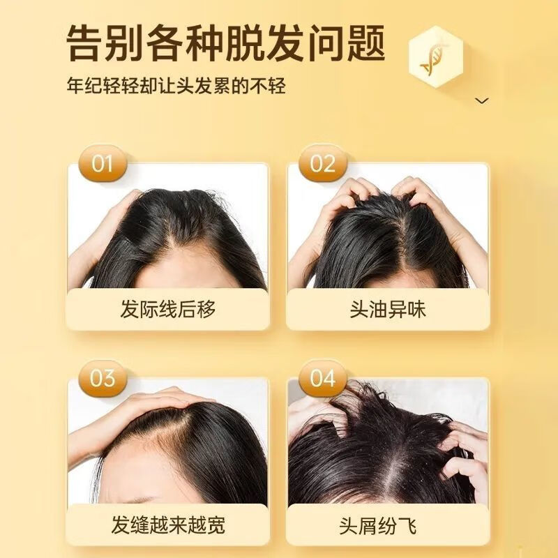 花瑶花瑶品防脱育发洗发水苗坚生姜护发固发滋养发根控油蓬松去屑洗发水 1瓶体验[持证防脱]轻度脱发适 300ml