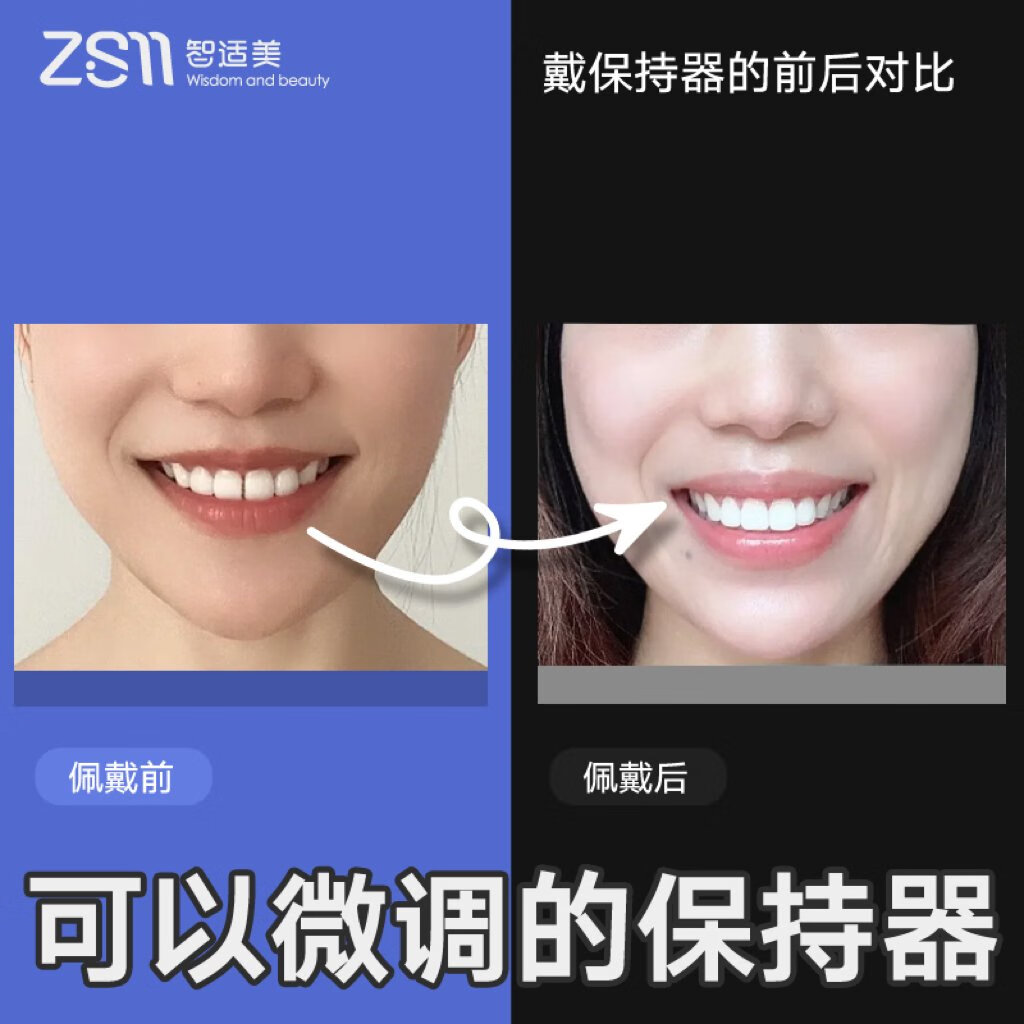 定制牙齿矫正器 隐形透明牙套钢丝地包天成人龅牙隐形矫正 上牙保持器