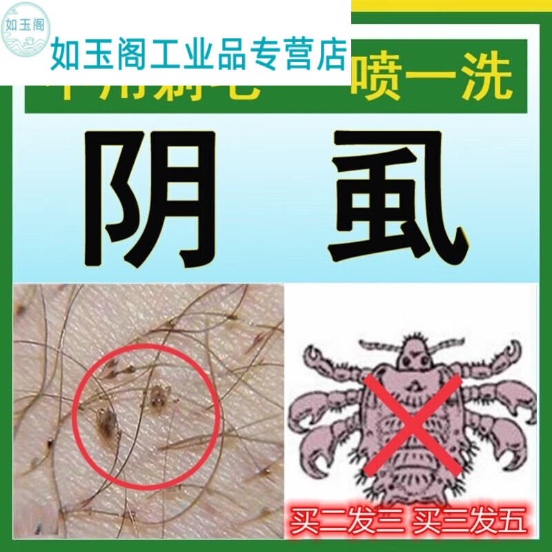 品质【精选好品】治疗阴虱病的药阴虱子药去除虱虫虱卵一扫光百部酊灭