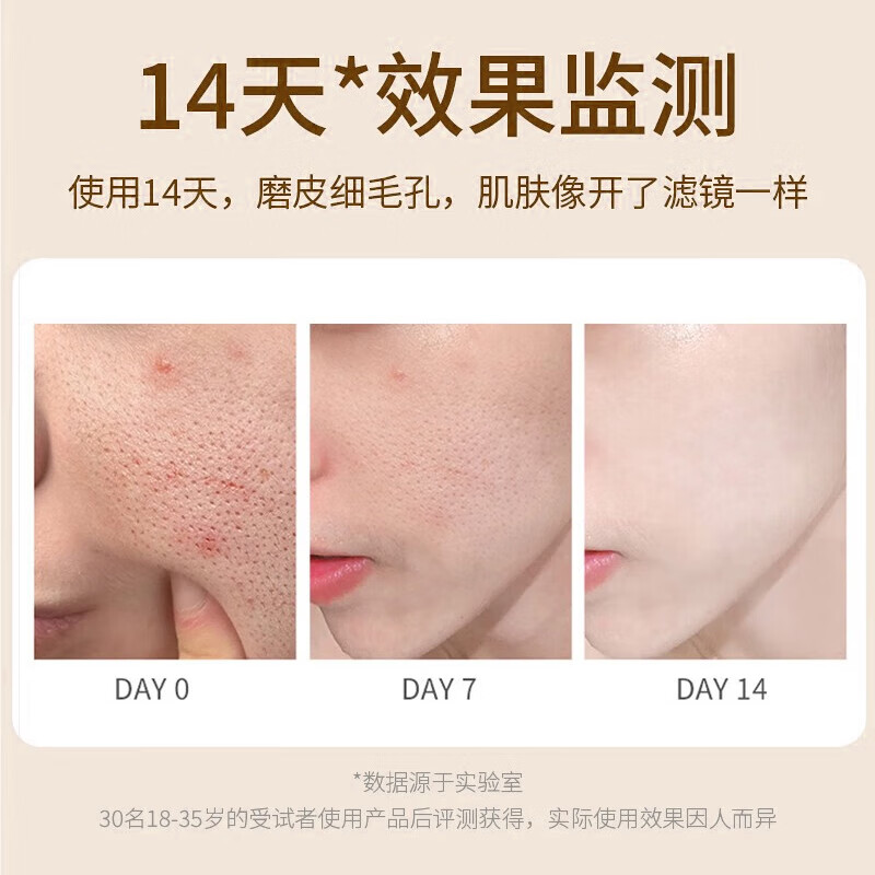 膜法记忆多酸净肤洁面乳壬二酸洗面奶男女深层清洁收缩毛孔去黑头2支装