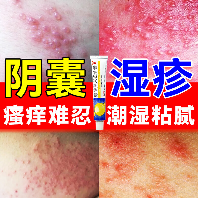 治疗阴囊潮湿瘙痒男人专用 男性阴囊湿疹 私处裆部潮湿潮热瘙痒药膏