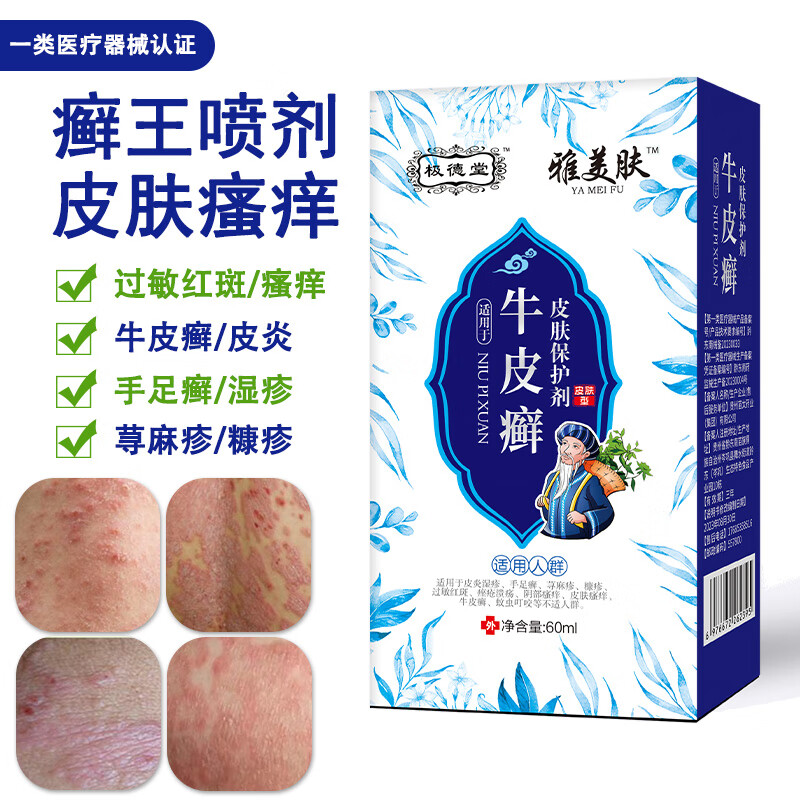 手足藓痒清皮炎湿疹牛皮癣专用苗药顽固牛皮癣银屑i病皮肤癣喷剂体癣药水股癣痒净花斑癣真菌感染疥疮专用膏 癣王喷剂+疥疮膏一支
