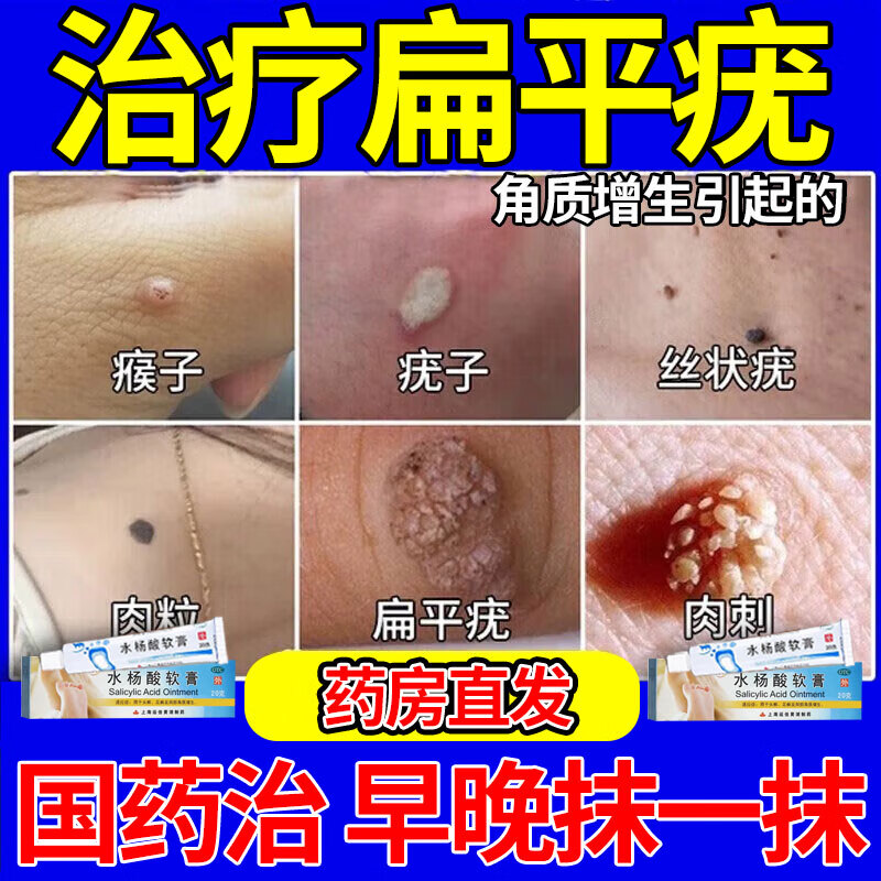 水杨酸软膏扁平疣用药祛疣膏面部脖子身体刺瘊子肉瘊子脂肪粒趾疣肉粒
