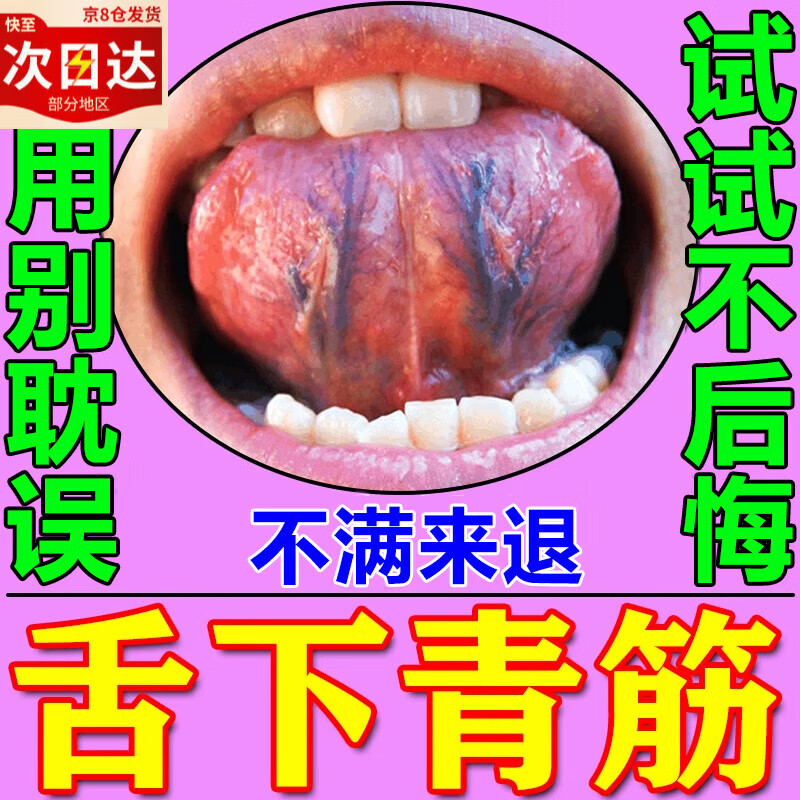 舌下青筋筋络发紫又黑又粗淤血疏通舌头底血管严重怒张紧挨舌下血 单